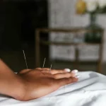 Comment l’acupuncture peut soulager les douleurs chroniques